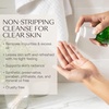 image:imageWeleda Deep Cleansing Gel