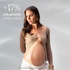 image:imageWeleda Stretch Mark Pregnancy Massage Oil 34 Fluid Ounce Plant Rich Oil with Vitamin E Sweet Almond Jojoba and Arnica Oils34 Fl Oz Pack of 2
